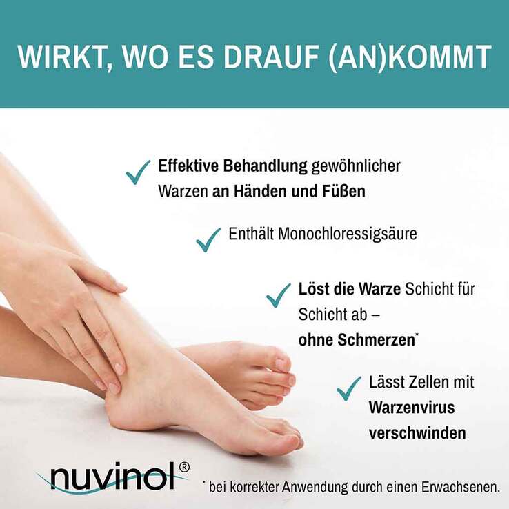 Nuvinol Warzenentferner Tinktur schmerzfrei, 2 ml