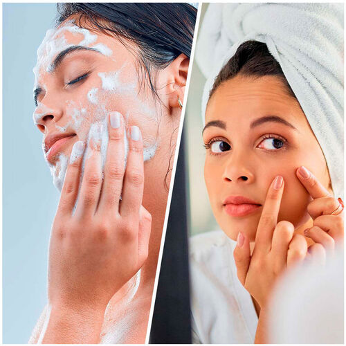 Biovène - Salicyclic Super Cleanser Face & Body Blackhead + Breakout