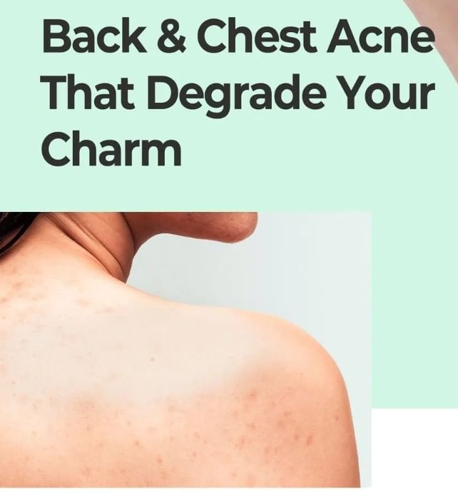 SOME BY MI - AHA, BHA, PHA Miracle Kalmerende Bodylotion