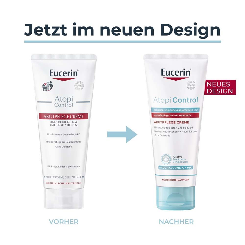 Eucerin® AtopiControl Akutpflege Creme hilft wirksam bei akuten Neurodermitisschüben, gegen Juckreiz, Hautrötungen und Entzündungen - Jetzt 3€ sparen mit Code 