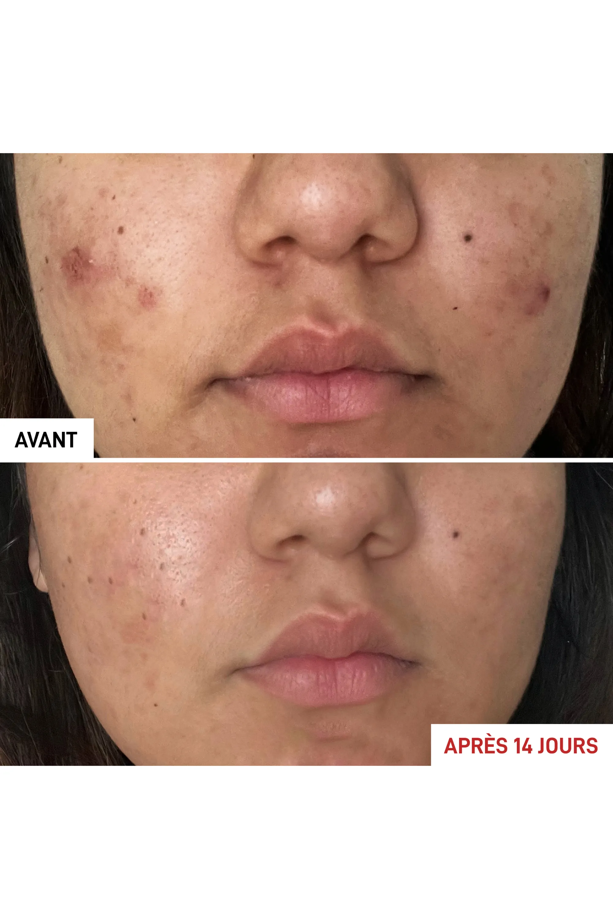 Erborian Fluide apaisant anti-imperfections Centella Acné Care-30 ml