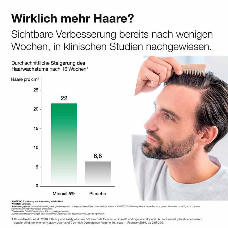 Alopexy 5% Lösung, 6x60 ml