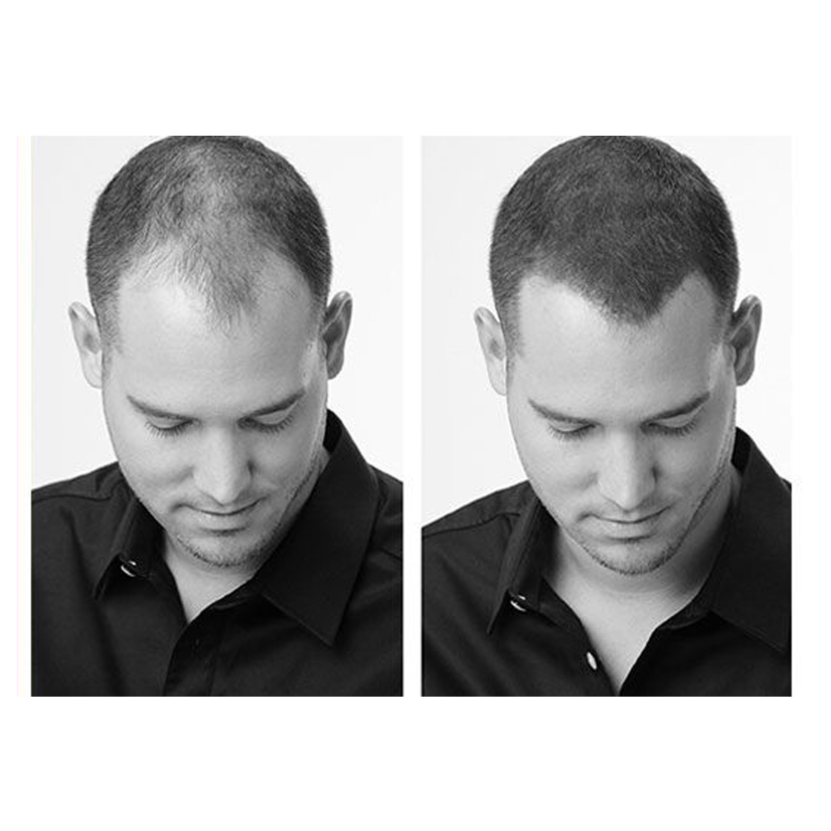 Hair 30 Chtain Clair