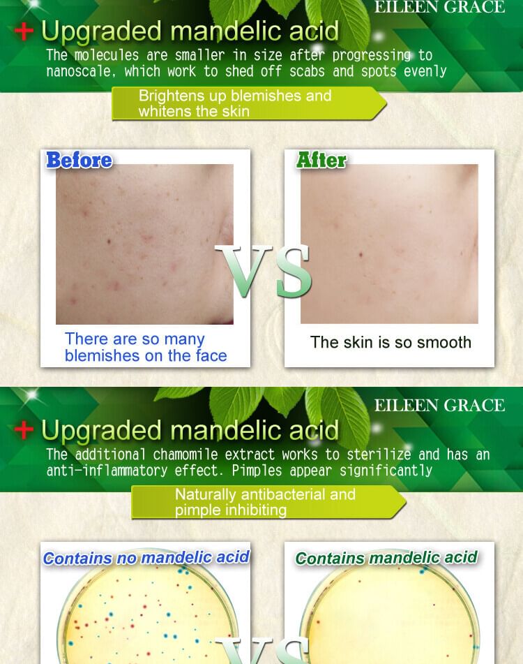 EILEEN GRACE - Flawless White Mandelic Acid Renewal Essence