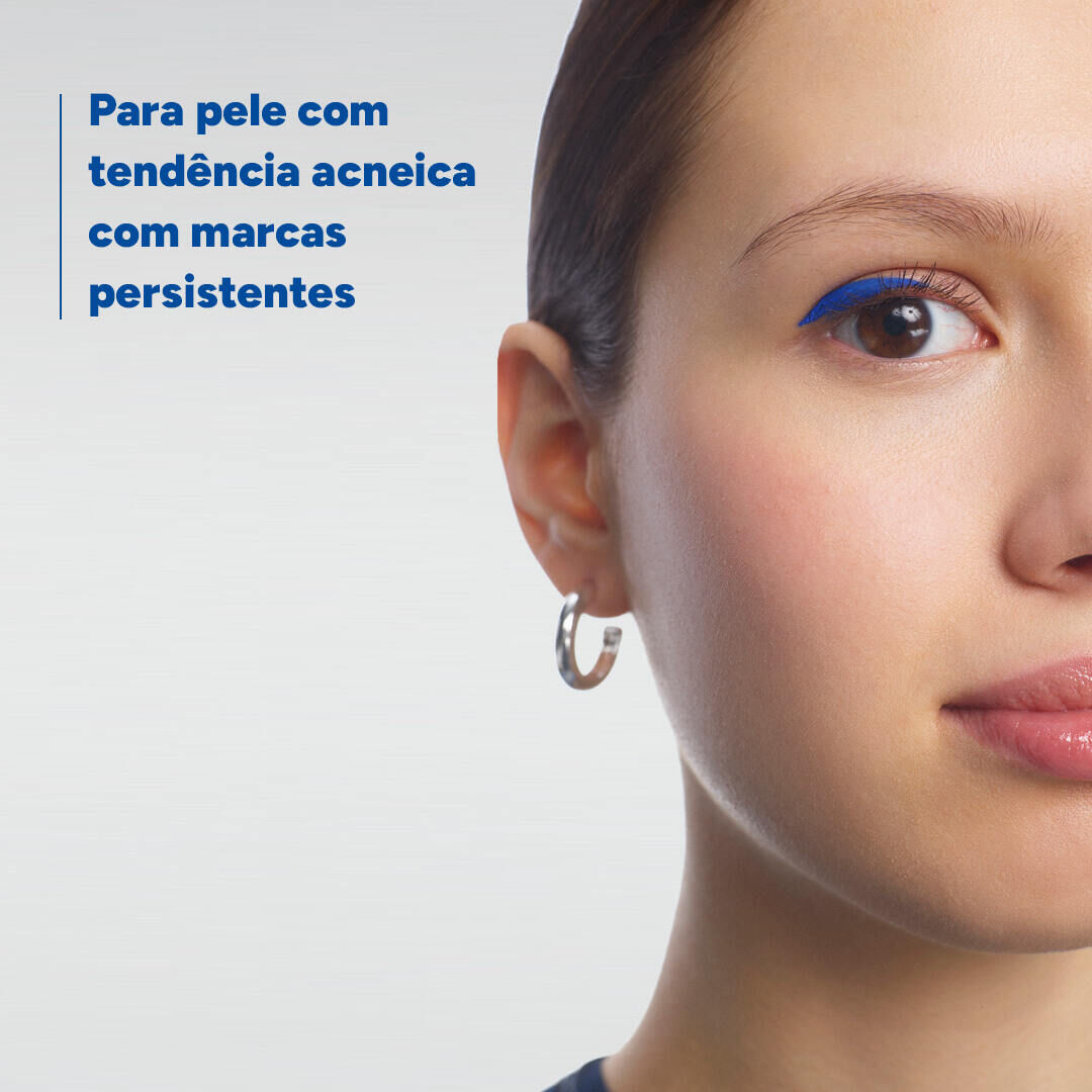 Ducray Keracnyl PP+ Creme Anti Imperfeições 30ml - 30ml