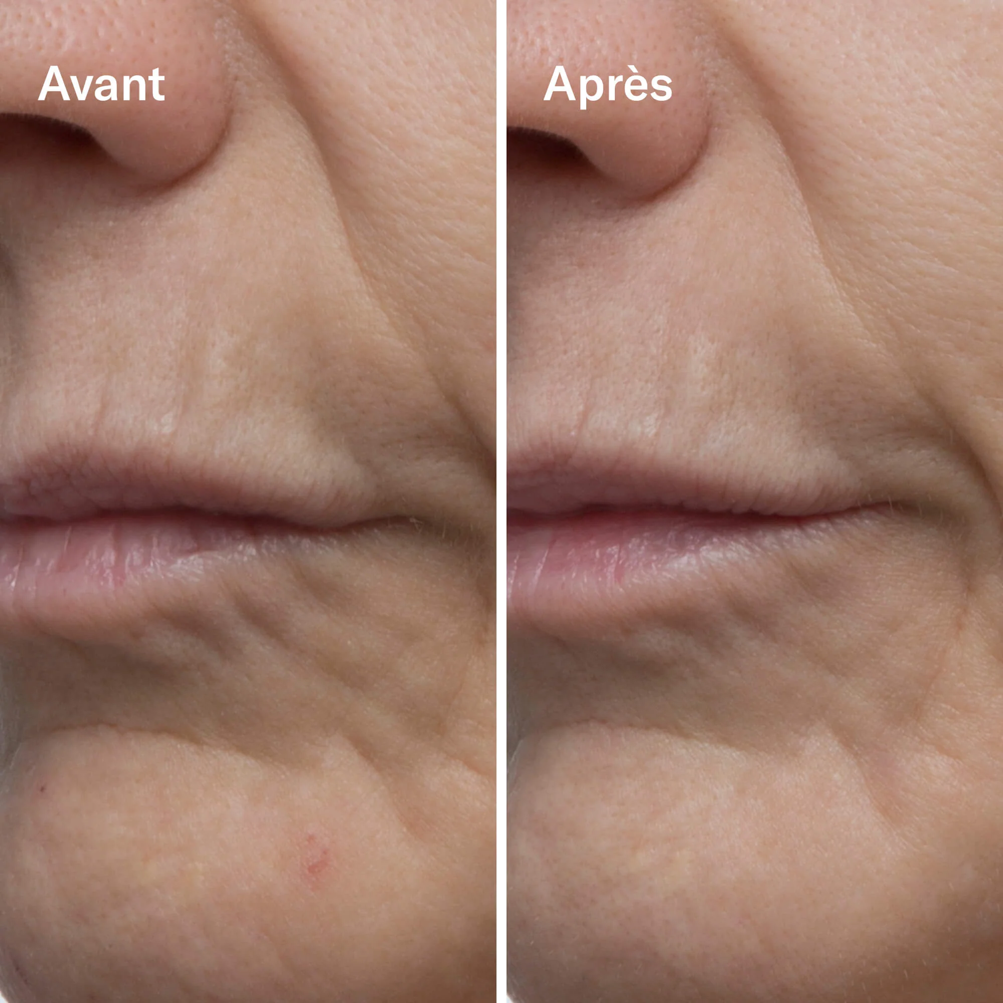 Odacité Clean-ical Renewing Serum Sérum Rénovant