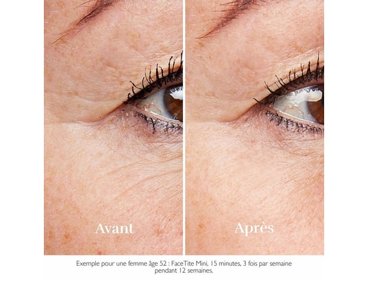 SILK'N - Dispositif anti-rides facetite mini ftm1pe1001