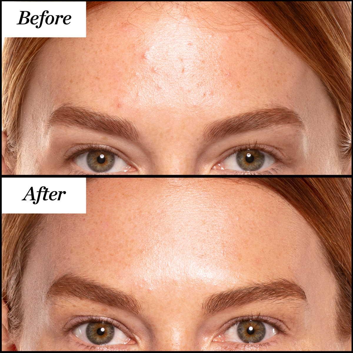 A+ High-Dose Retinoid Serum 30ml