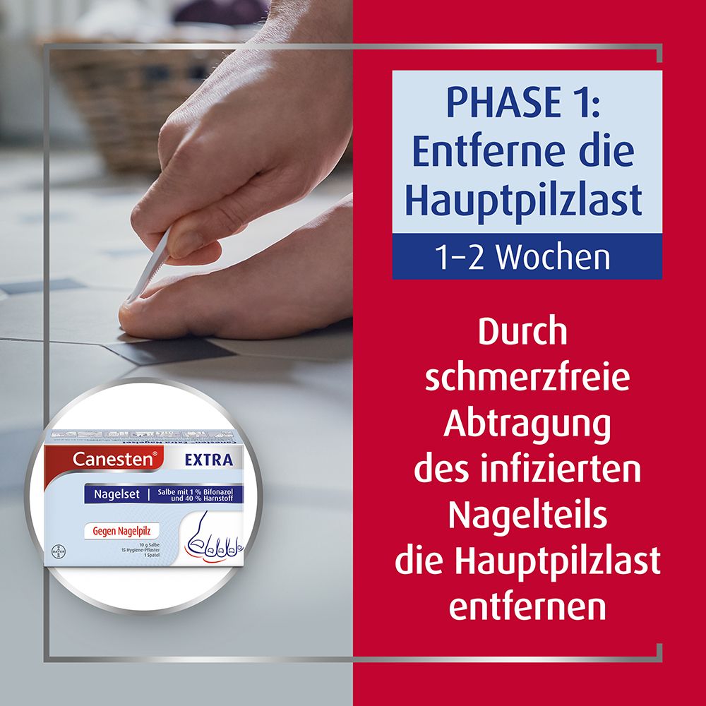 Canesten® EXTRA 2-Phasen-Kurztherapie-Set bei Nagelpilz