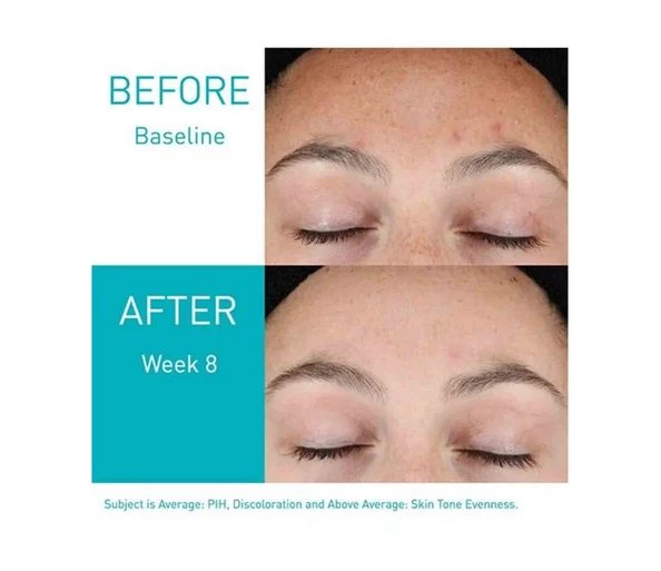 CERAVE Resurfacing Retinol Serum