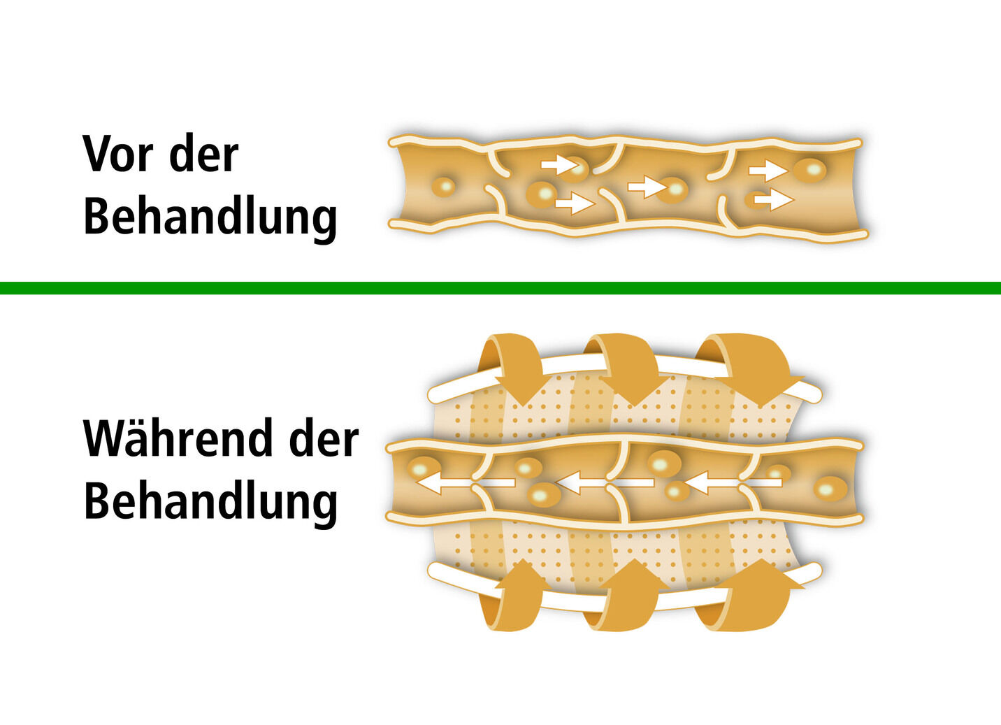 Beurer Venen-Massagegerät FM 150