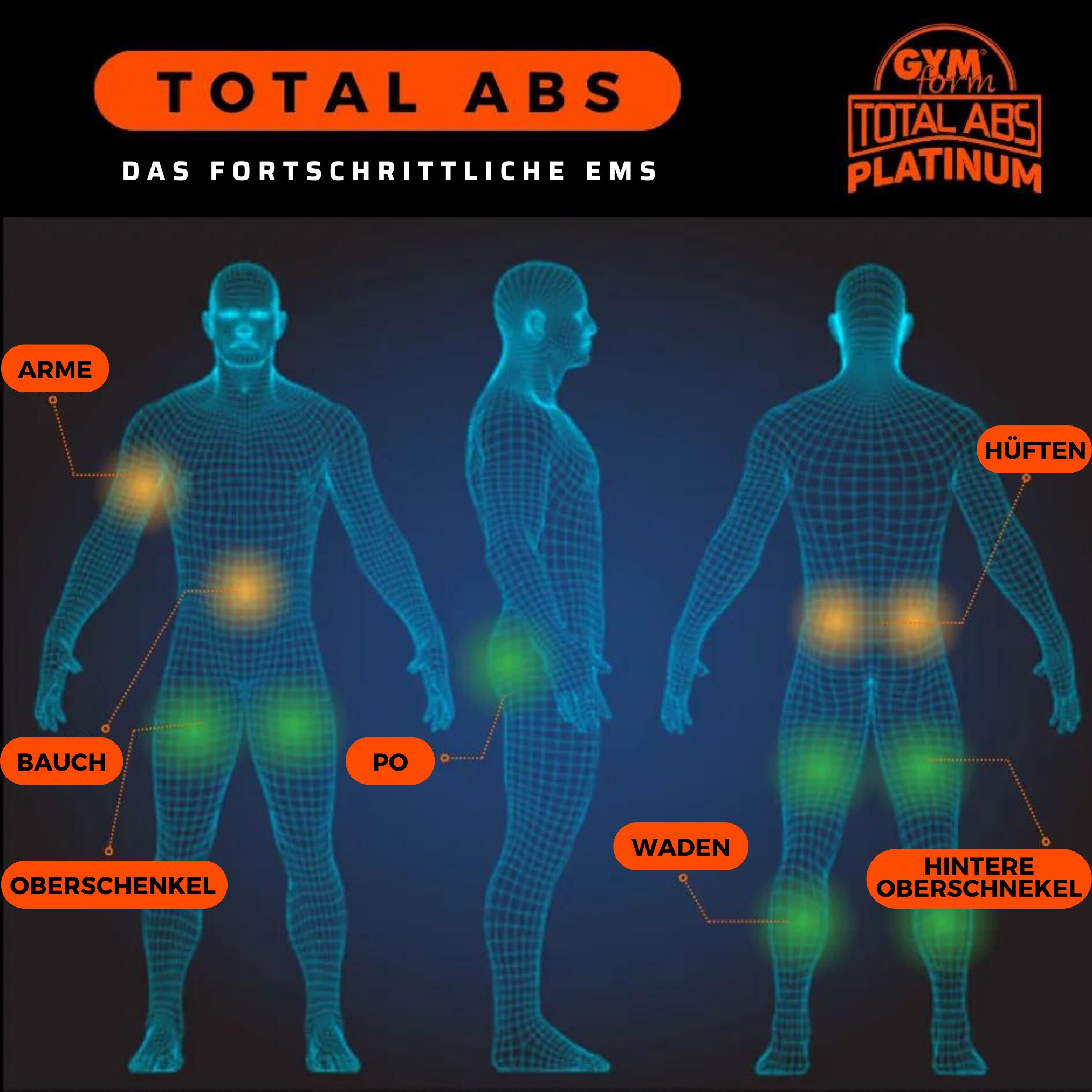 Gymform® EMS Bauchmuskeltrainer - Gürtel Trainer elektrisch Total Abs Platinum