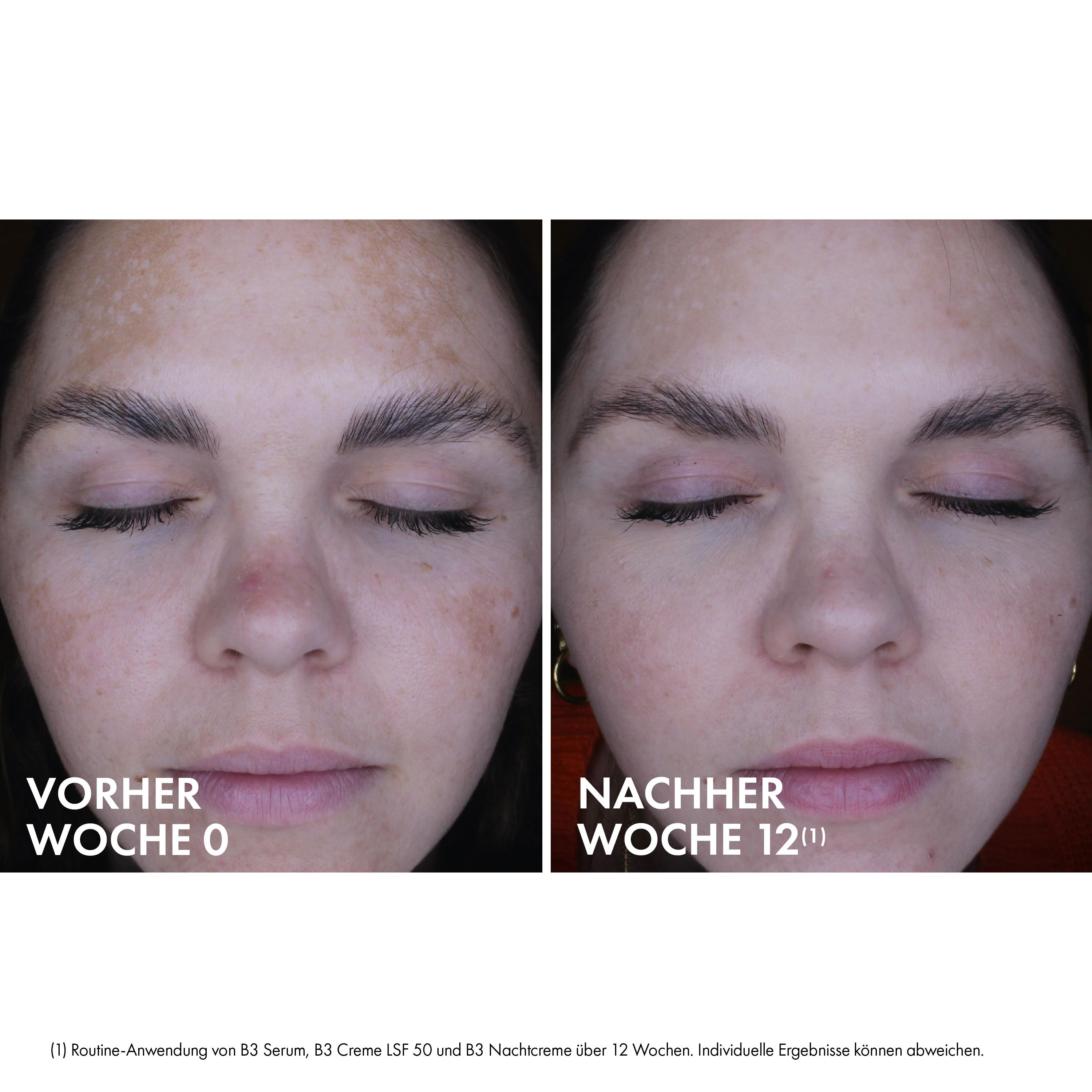 Vichy LIFTACTIV B3 Retinol Anti-Pigmentflecken Nachtcreme