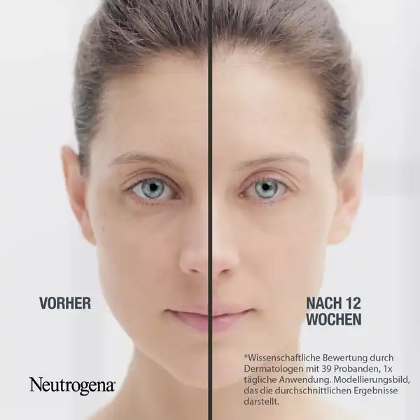 Anti-Age Retinol Boost Vorteilsset