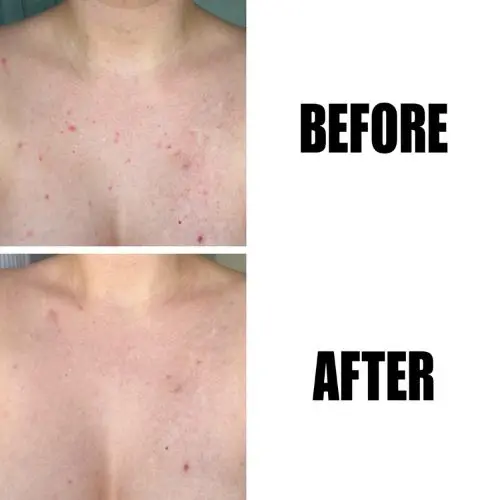 Glycolic Acid Exfoliating Body Stick