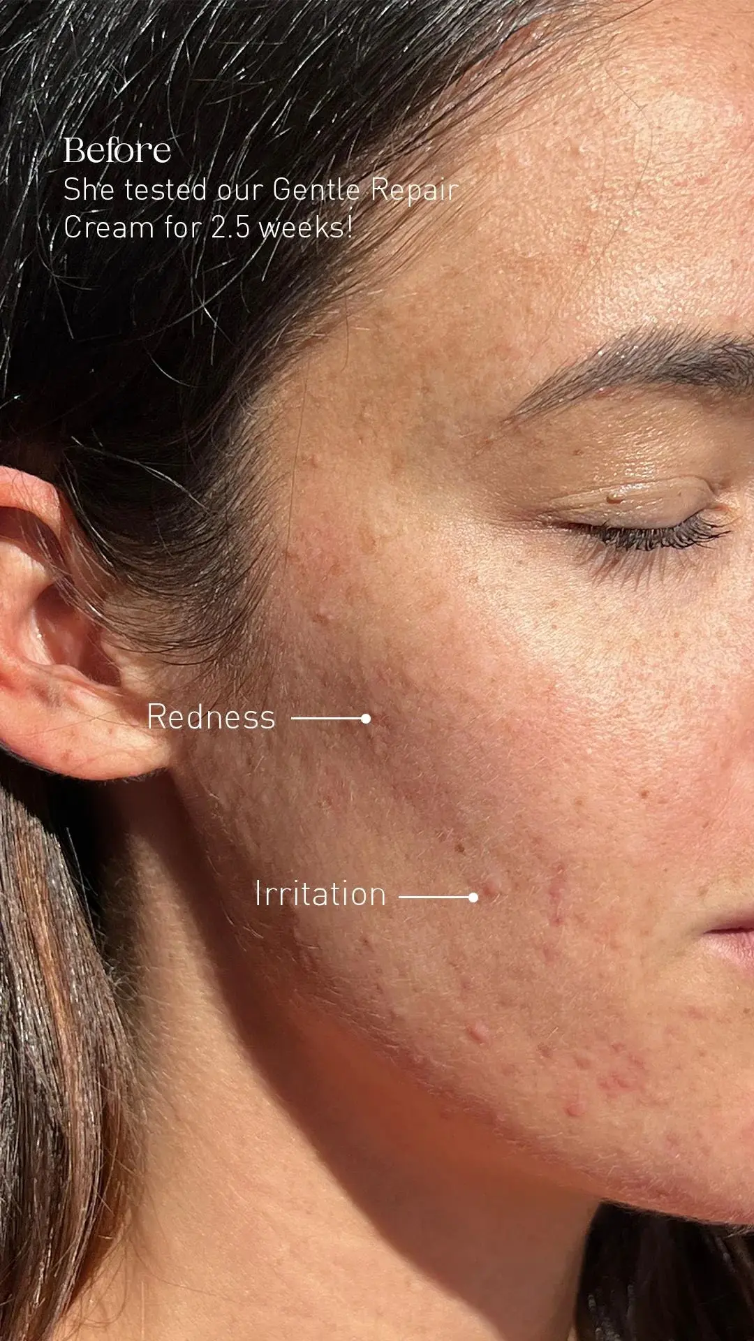 Gentle Repair Cream