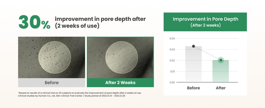 AXIS - Y - LHA Peel&Fill Poriënbalancerende Crème