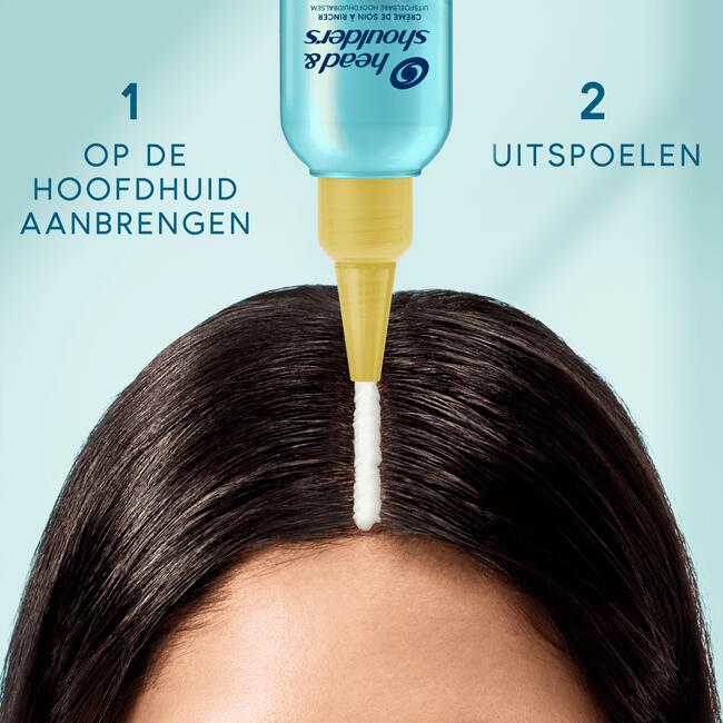 Head & Shoulders Derma X Pro Kalmeert Hoofdhuidbalsem Anti-roos 145ML