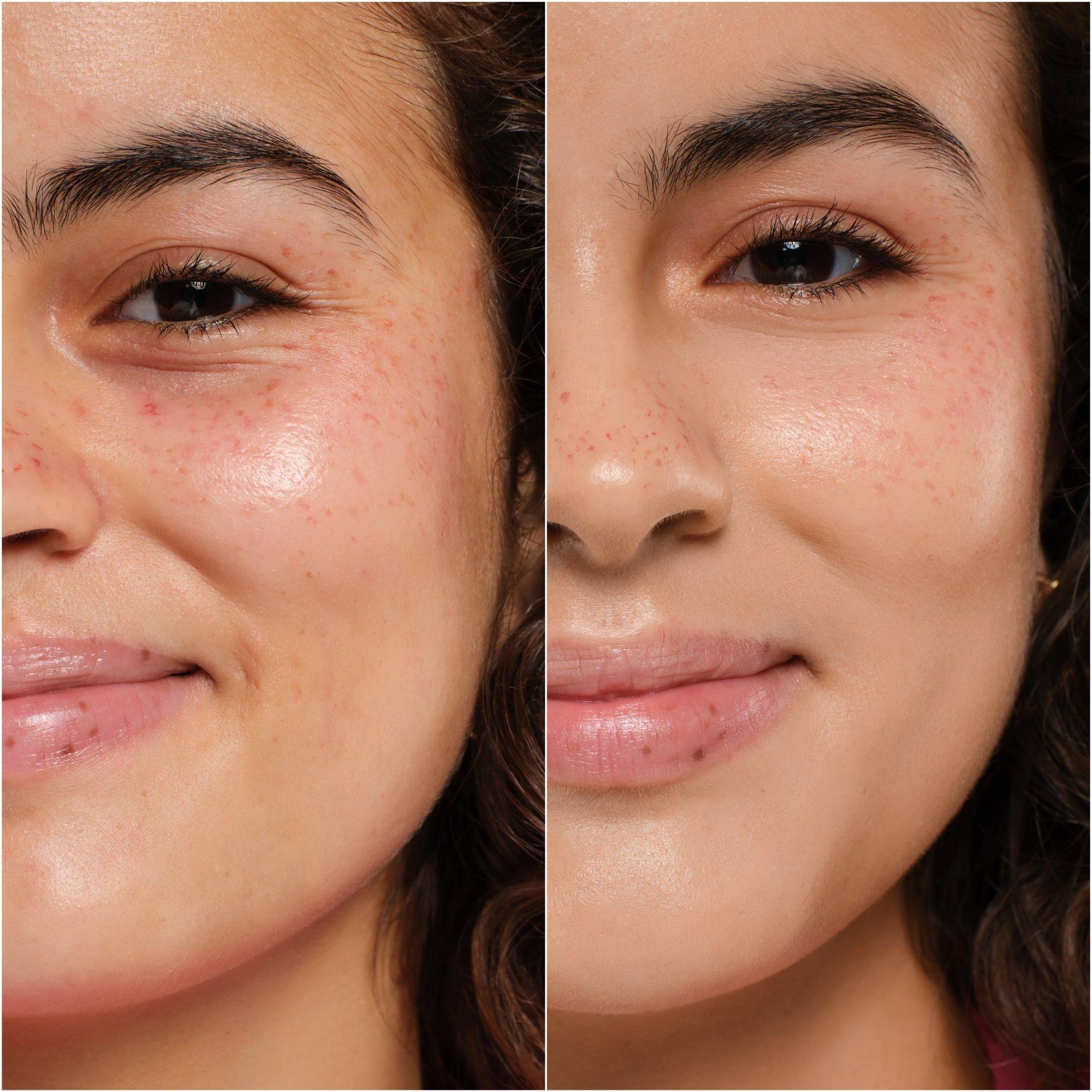 SKIN tint