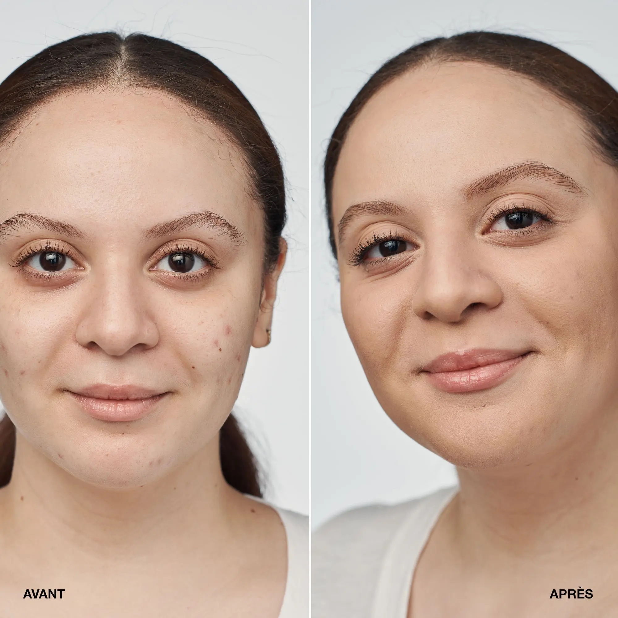 Clinique - Even Better Clinical Fond de Teint Sérum SPF 20- Fond de Teint