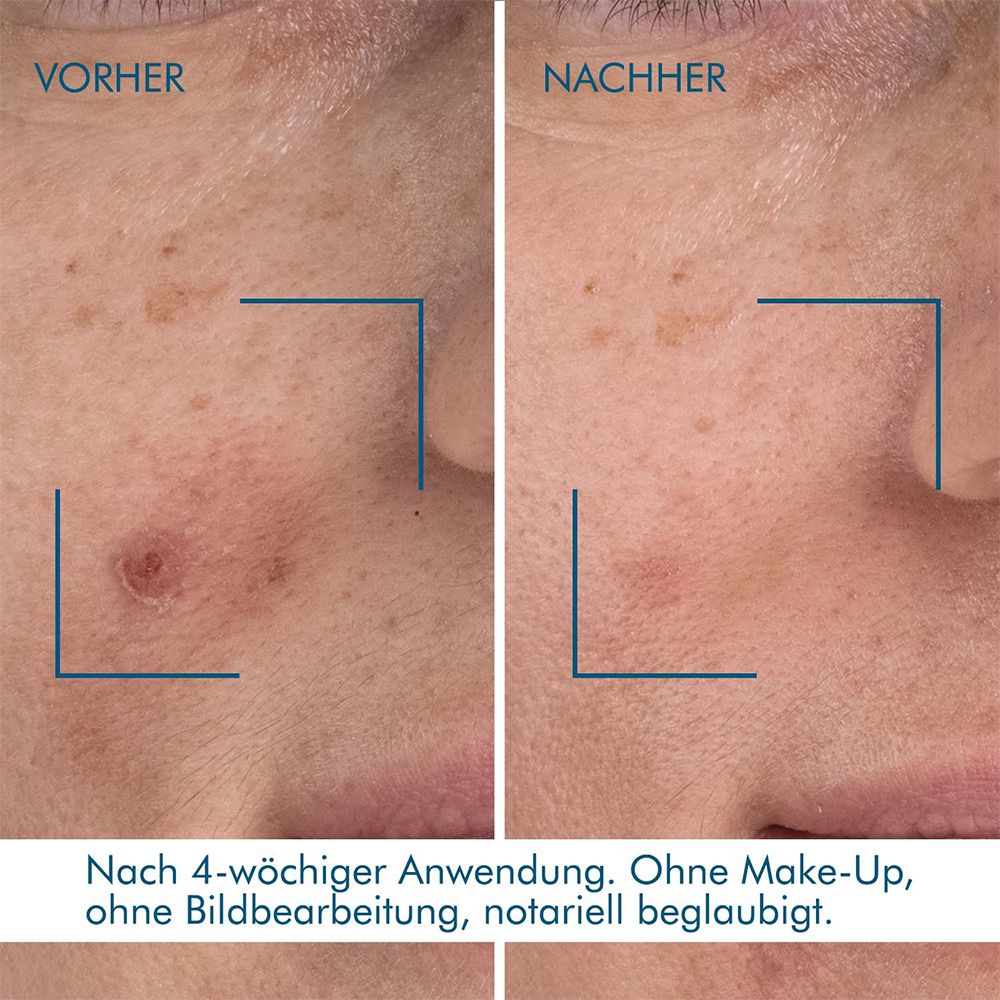 BIOTHERM Blue Retinol Nachtserum - Jetzt 20% sparen mit Code 
