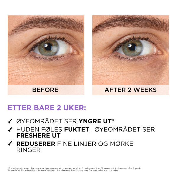 Revitalift Filler Eye Serum