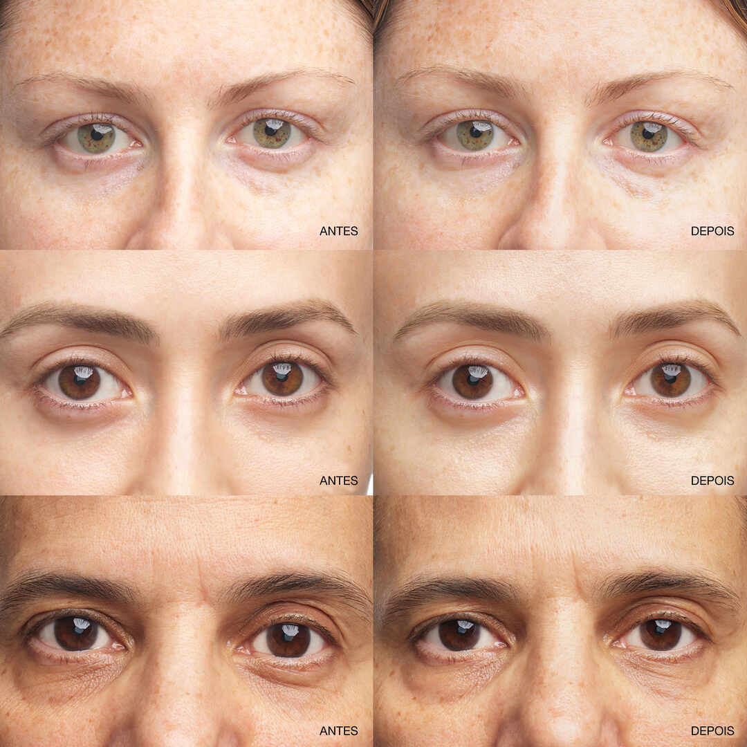 CLINIQUE All About Eyes Brightening Serum Concentrate - 10ml