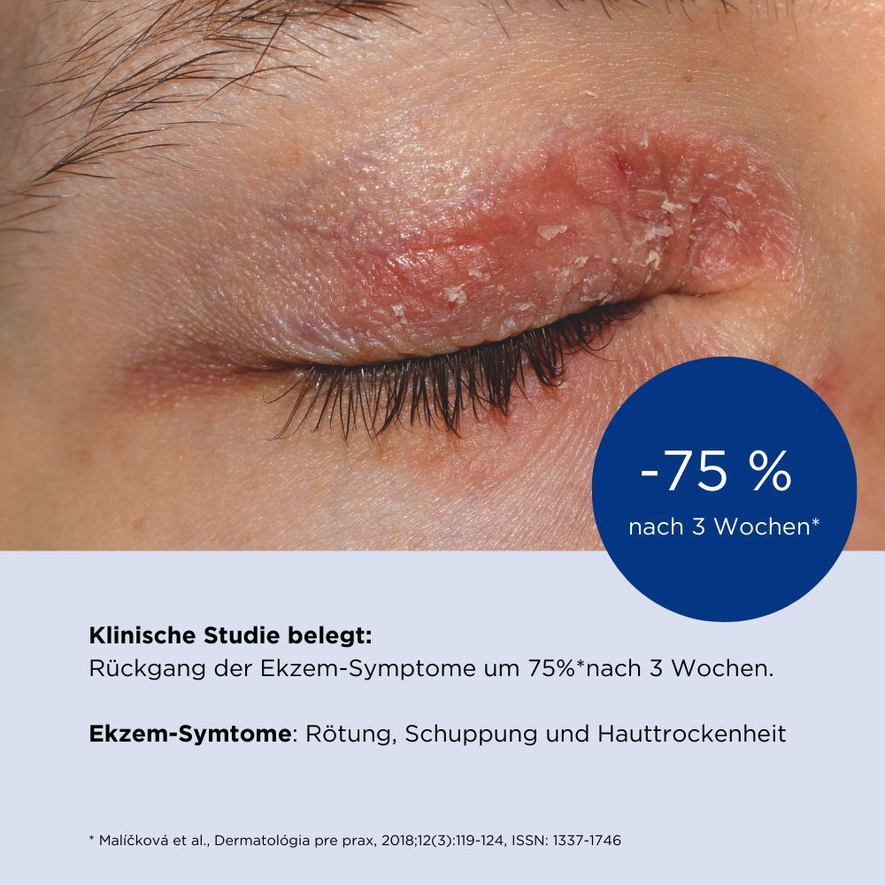 ALLERGIKA® Augenlidcreme MED - Jetzt 2 Euro sparen mit code ,,allergika2''