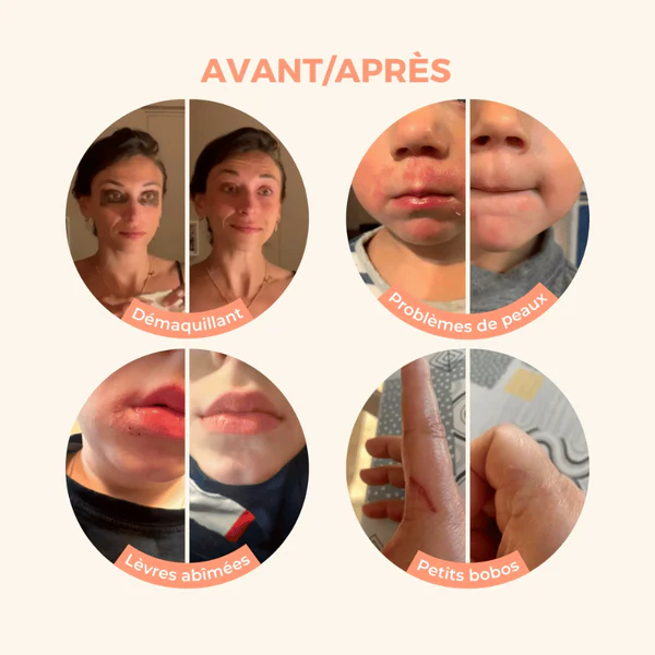 Les petits prödiges Baume Magique Fleur d'Oranger - 30 mL