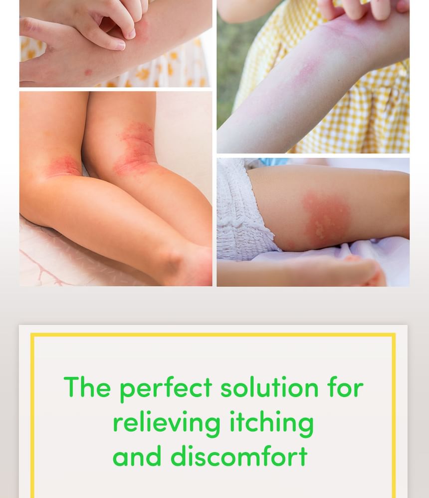 Formal Bee - Kinder Derma Barrier Jeukpleister