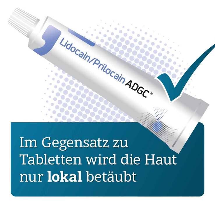 Lidocain / Prilocain ADGC 25 mg / g + 25 mg / g Creme, 30 g