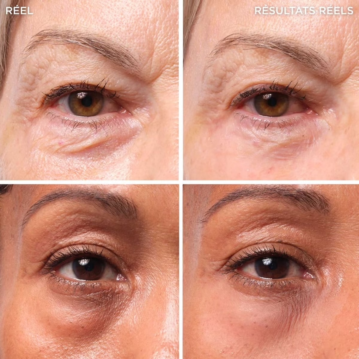 It Cosmetics Bye Bye Under Eye Bags Traitement pour les poches