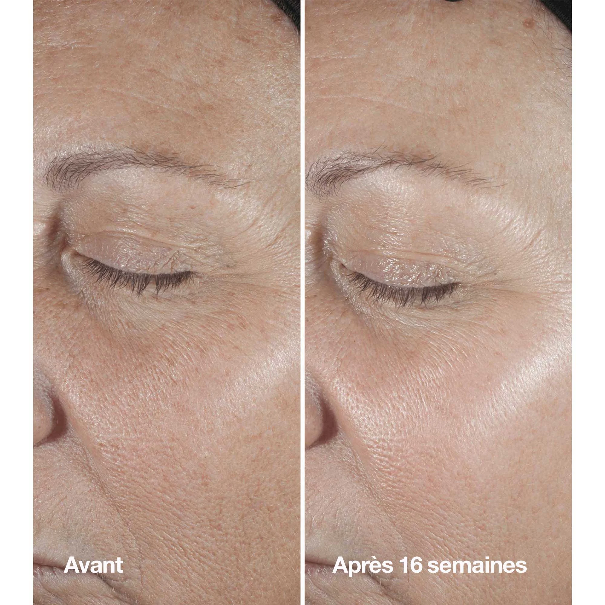 Clinique Smart Clinical Serum - Sérum Correcteur Anti-rides |