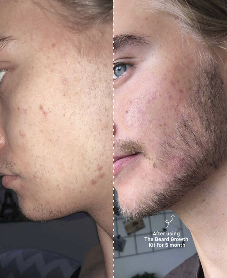 Copenhagen Grooming The Beard Growth Kit