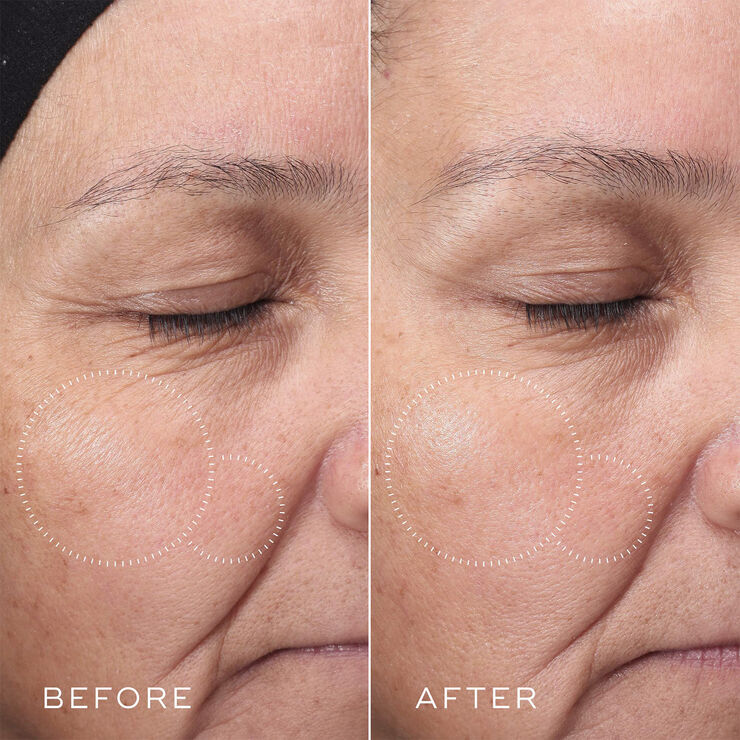 MEDIK8 Press & Glow