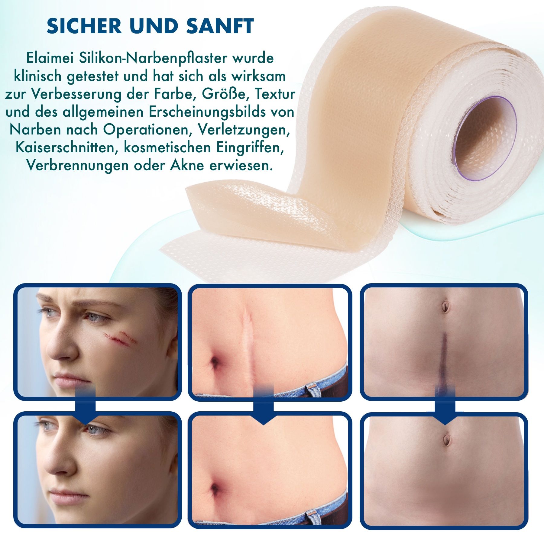 P-Beauty Wundpflaster für Narben