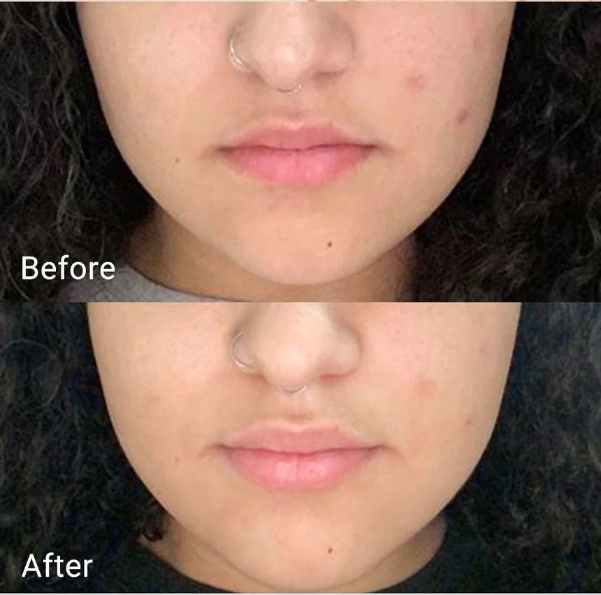 APRILSKIN - Echte Calendula Peel Off Pack