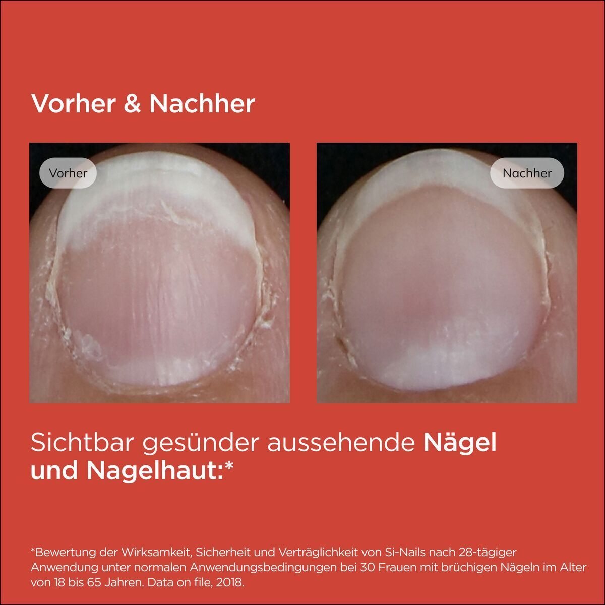 ISDIN® Si-Nails Nagelhärter