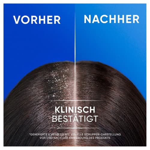 Head & Shoulders Classic Clean 2in1 Anti-Schuppen-Shampoo 250ml