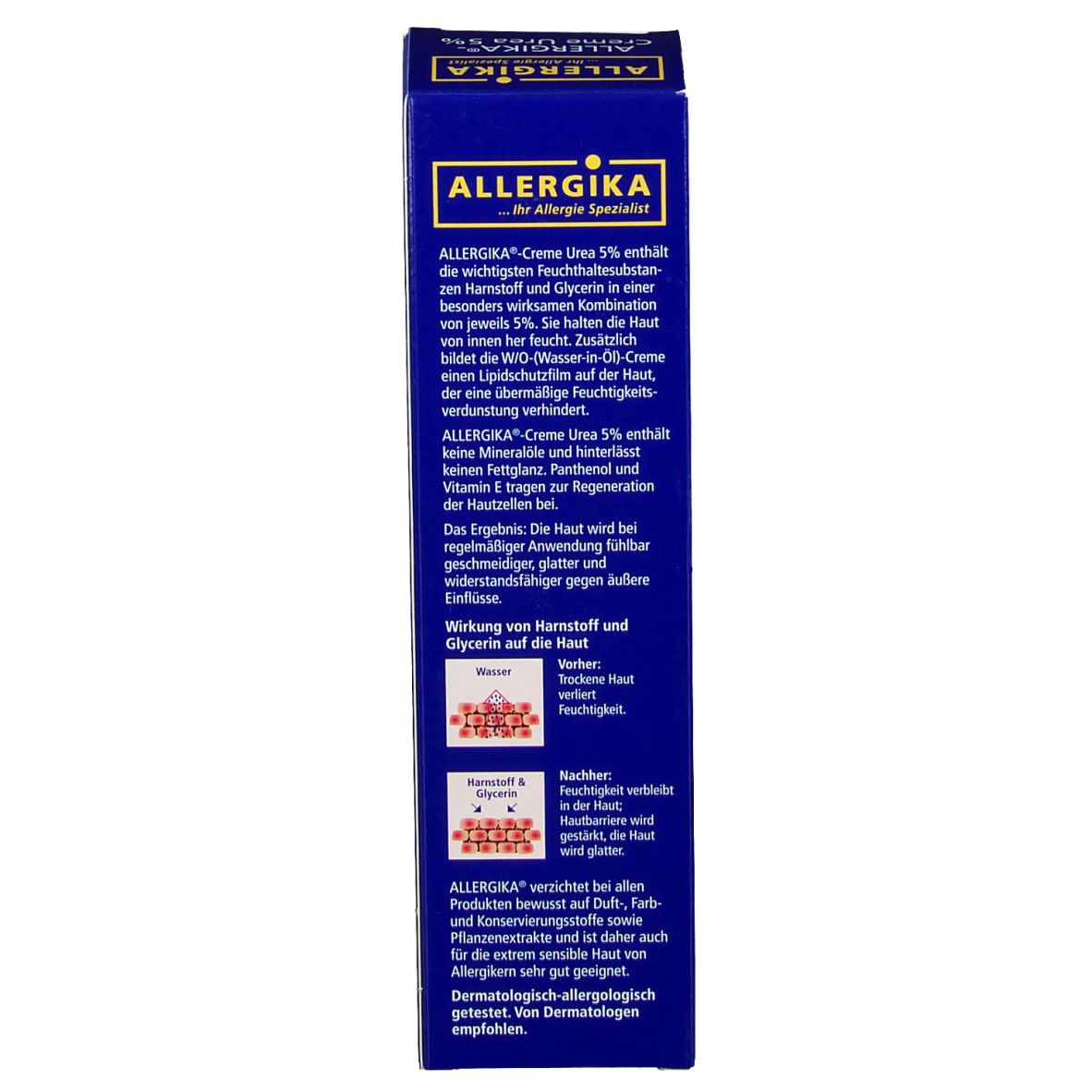 ALLERGIKA® Creme Urea 5% - Medizinische Spezialpflege zur Vorbeugung von Juckreiz und Schuppung, zur lokalen Intensivpflege an Händen, Ellbogen und Beinen