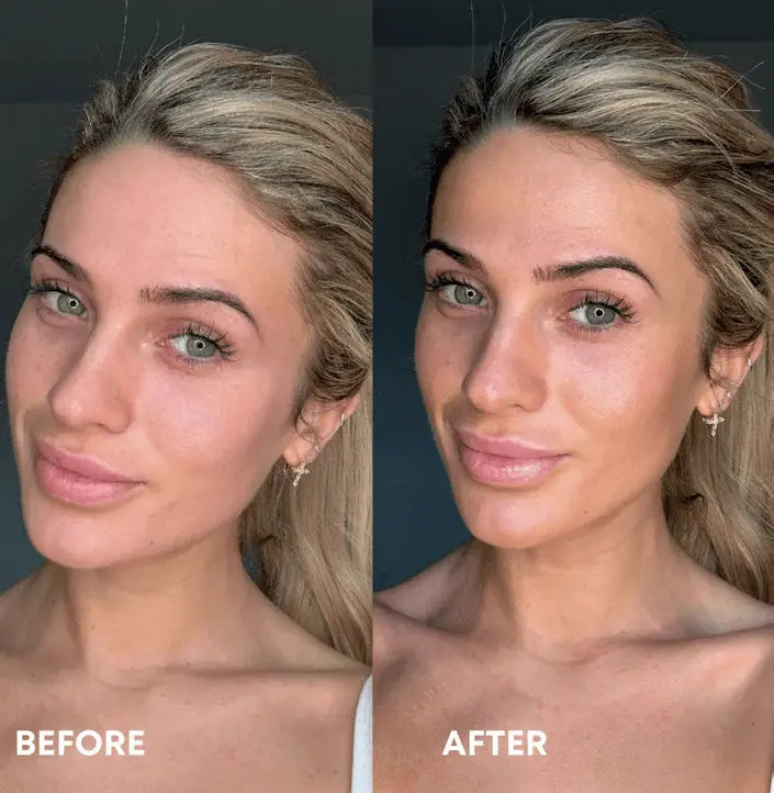 Beauty Blur Medium