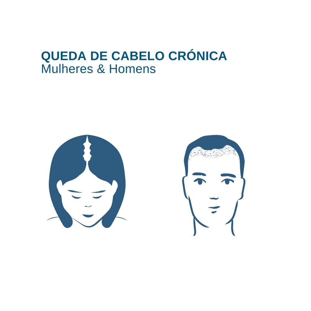 Cápsulas Queda Cabelo Crónica Anacaps Expert - 30un