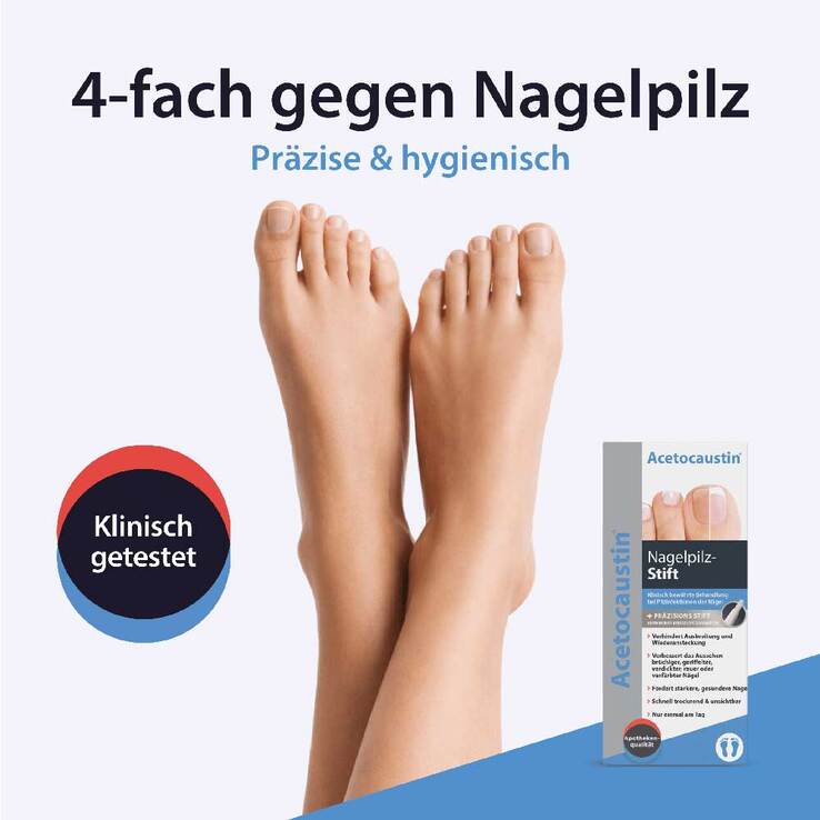 Acetocaustin Nagelpilz Stift gegen Nagelpilz, 4 ml