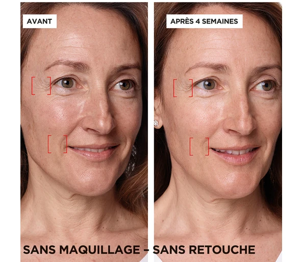 L'ORÉAL PARIS Revitalift Laser X3 Anti-Age Intensiv-Pflege Tag