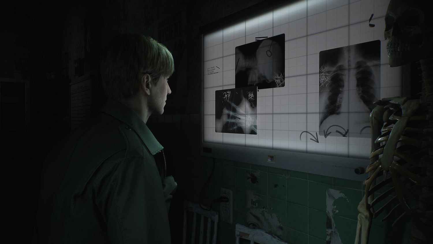 Silent Hill 2 Remake- PlayStation 5