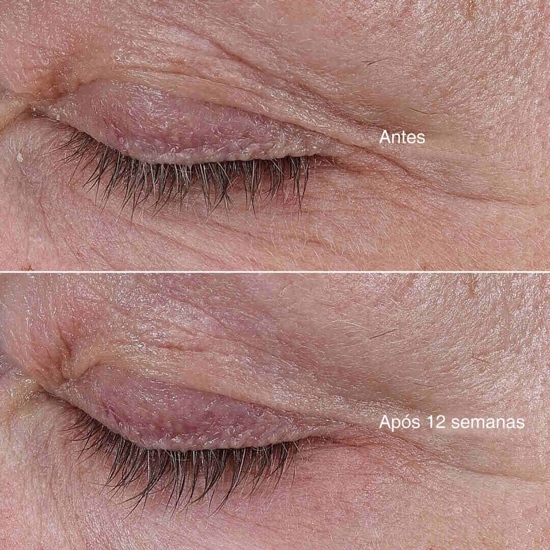La Mer Tratamento The Rejuvenating Eye Cream - 15ml