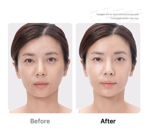 medicube - AGE-R Booster Pro