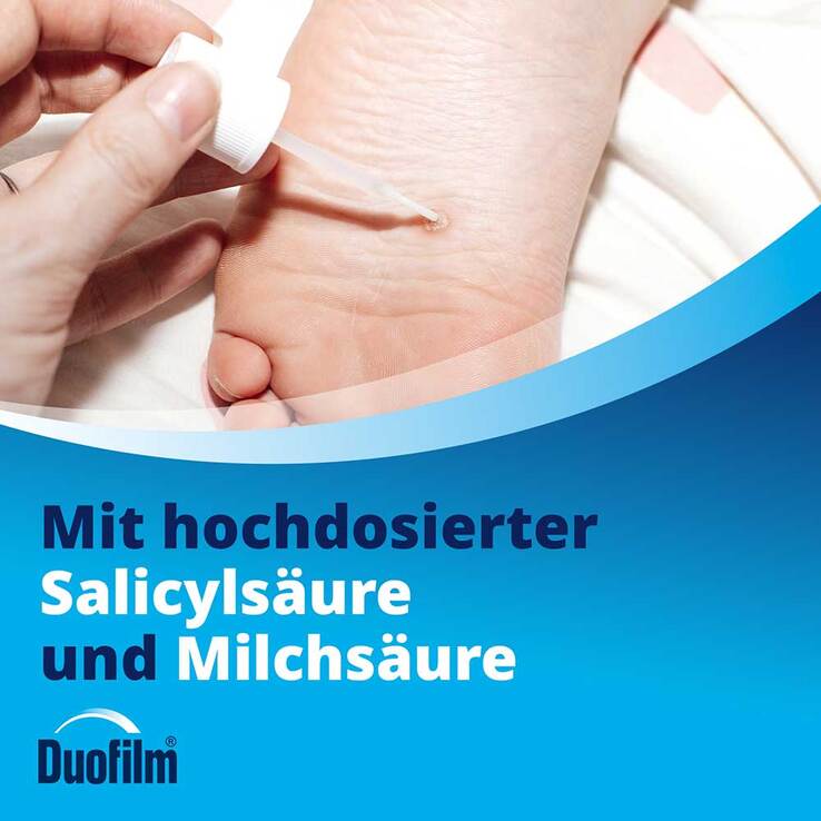 Duofilm Lösung, 15 ml