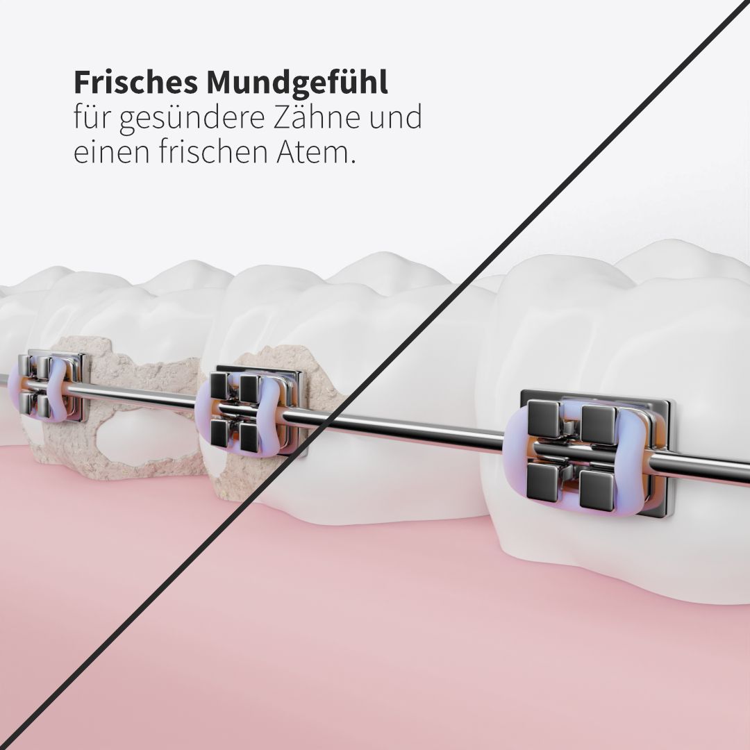 Zahnheld Ersatzdüsen Basic schwarz (6 Stück)