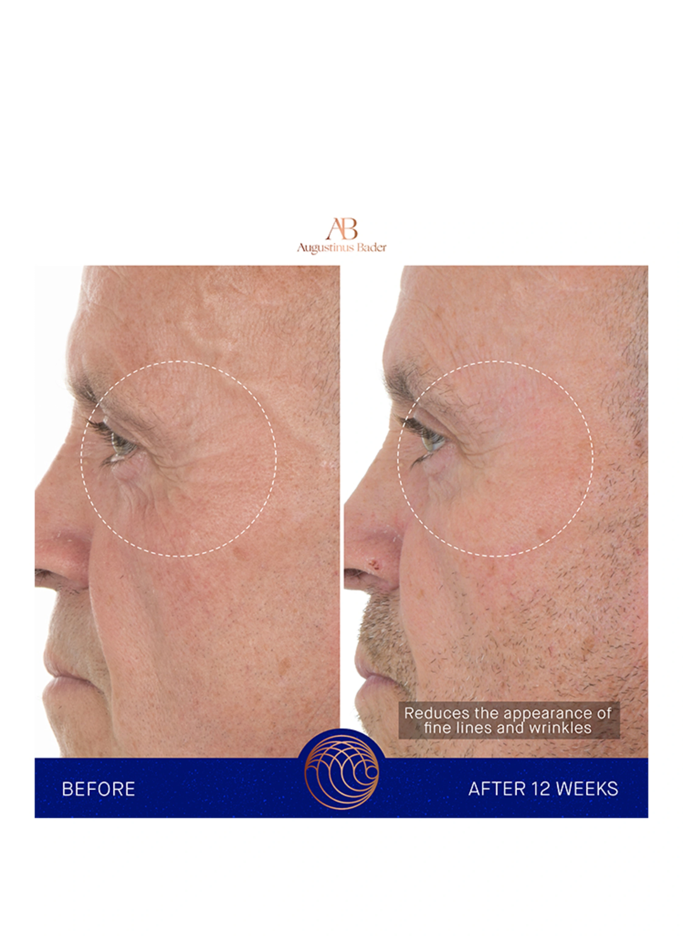 Augustinus Bader THE RETINOL SERUM